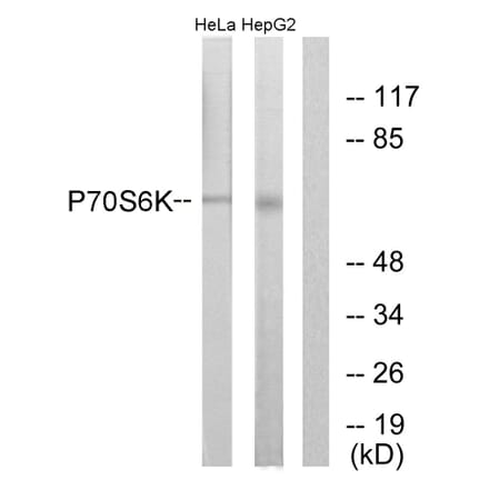 Western Blot - Anti-p70 S6 Kinase Antibody (B0532) - Antibodies.com