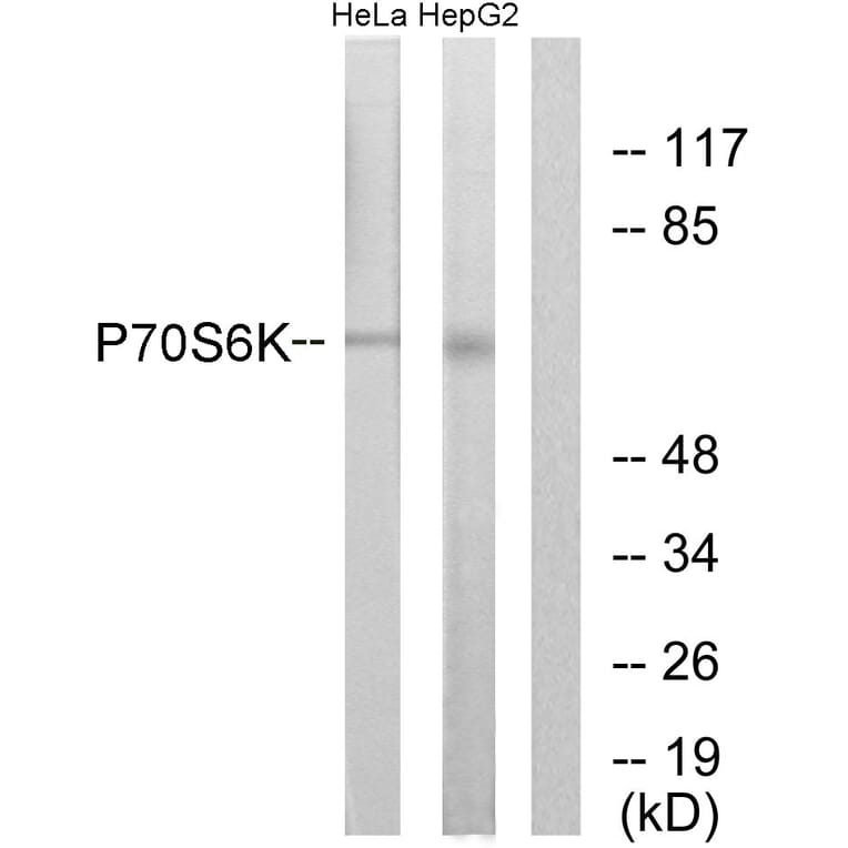 Western Blot - Anti-p70 S6 Kinase Antibody (B0532) - Antibodies.com
