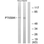Western Blot - Anti-p70 S6 Kinase Antibody (B0532) - Antibodies.com