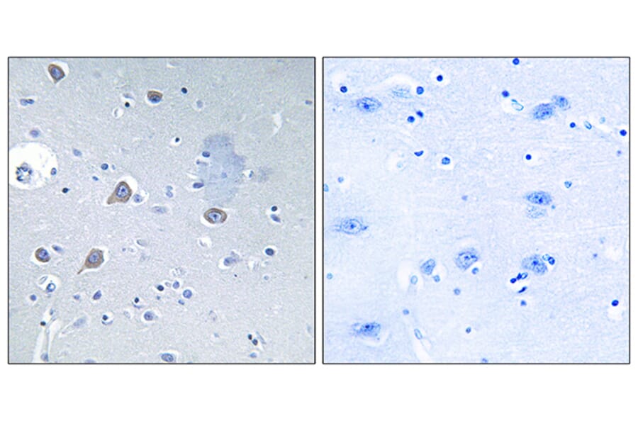 Immunohistochemistry - Anti-p70 S6 Kinase Antibody (B0532) - Antibodies.com