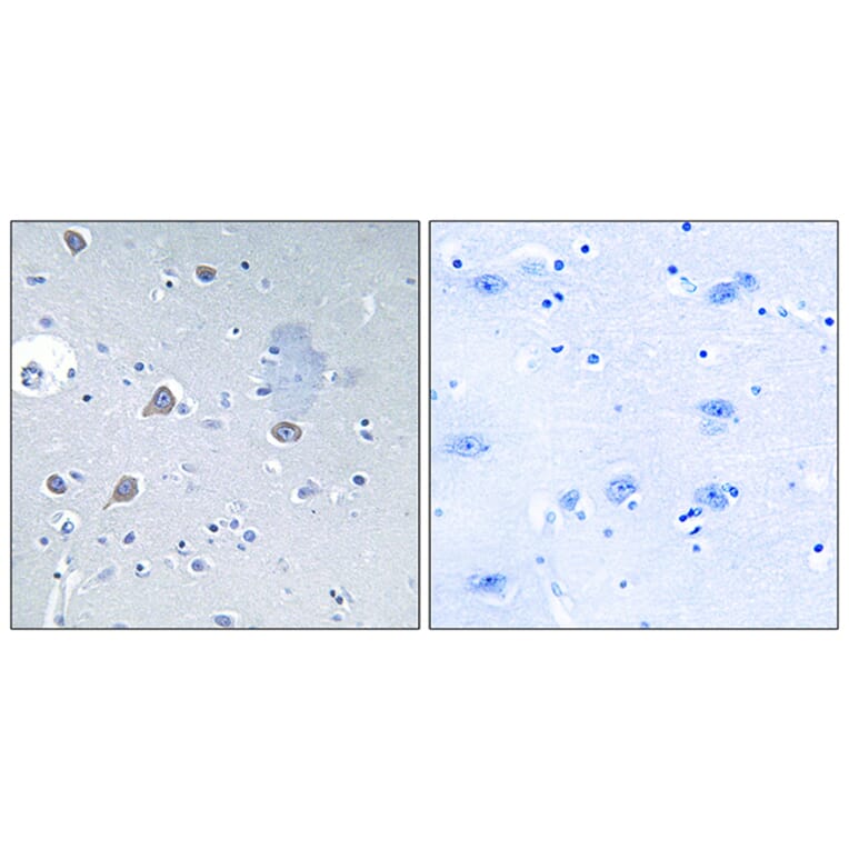 Immunohistochemistry - Anti-p70 S6 Kinase Antibody (B0532) - Antibodies.com