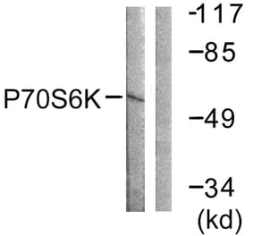 Western Blot - Anti-p70 S6 Kinase Antibody (B0531) - Antibodies.com