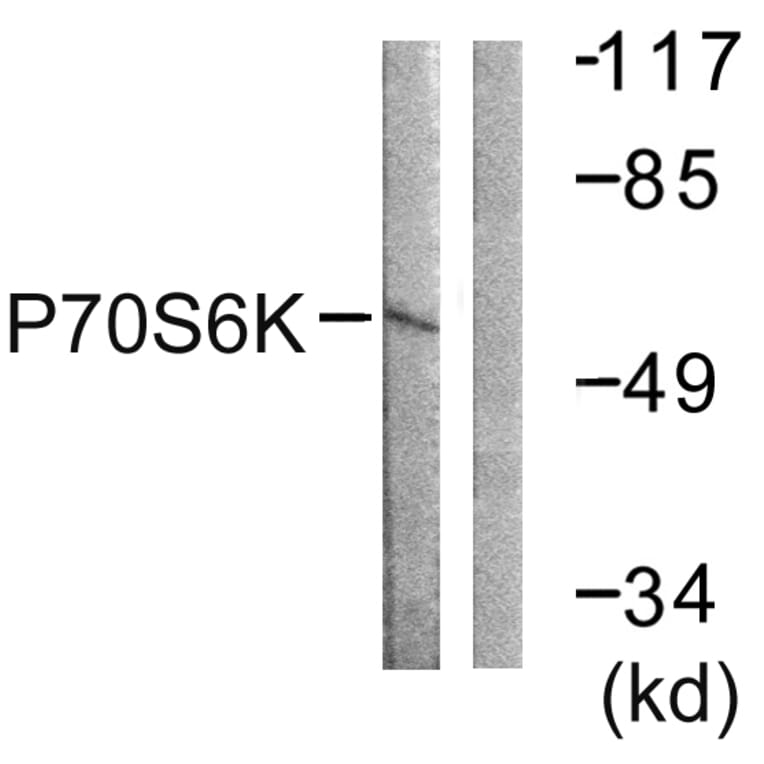 Western Blot - Anti-p70 S6 Kinase Antibody (B0531) - Antibodies.com