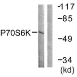 Western Blot - Anti-p70 S6 Kinase Antibody (B0531) - Antibodies.com