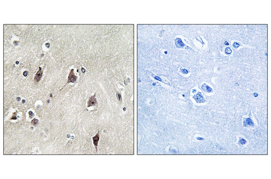 Immunohistochemistry - Anti-p70 S6 Kinase Antibody (B0531) - Antibodies.com