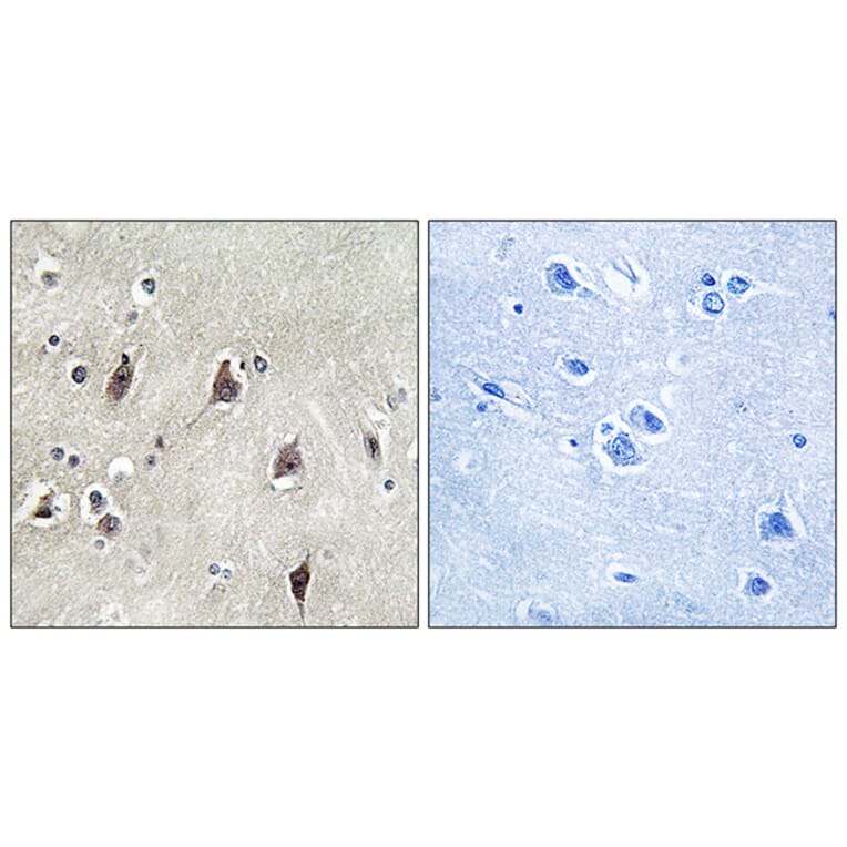 Immunohistochemistry - Anti-p70 S6 Kinase Antibody (B0531) - Antibodies.com