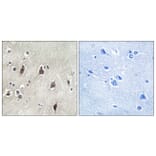 Immunohistochemistry - Anti-p70 S6 Kinase Antibody (B0531) - Antibodies.com