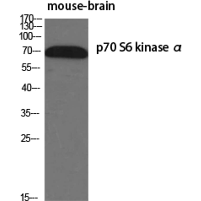 Western Blot - Anti-p70 S6 Kinase Antibody (B0531) - Antibodies.com