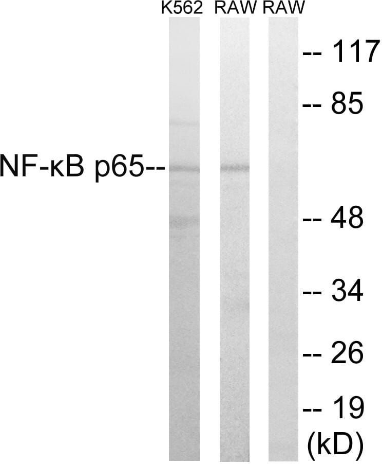 Anti-NF-kappaB P65 Anticorpo (A93919) | Antibodies.com