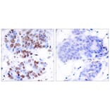 Immunohistochemistry - Anti-NF-kappaB p65 Antibody (B7169) - Antibodies.com