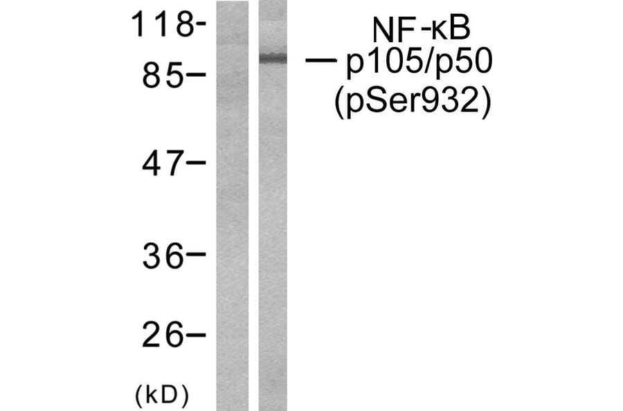 Western Blot - Anti-NF kappa B p105 / p50 (phospho Ser932) Antibody (A7161) - Antibodies.com