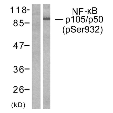 Western Blot - Anti-NF kappa B p105 / p50 (phospho Ser932) Antibody (A7161) - Antibodies.com