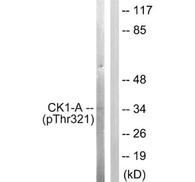 Western Blot - Anti-Casein Kinase I alpha (phospho Tyr321) Antibody (A1194) - Antibodies.com