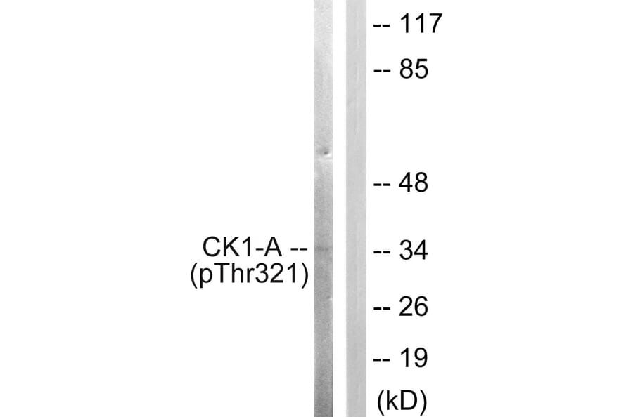 Western Blot - Anti-Casein Kinase I alpha (phospho Tyr321) Antibody (A1194) - Antibodies.com