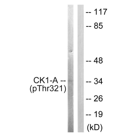 Western Blot - Anti-Casein Kinase I alpha (phospho Tyr321) Antibody (A1194) - Antibodies.com