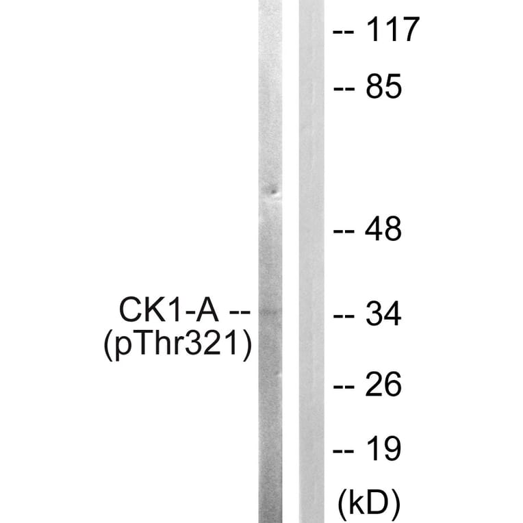 Western Blot - Anti-Casein Kinase I alpha (phospho Tyr321) Antibody (A1194) - Antibodies.com