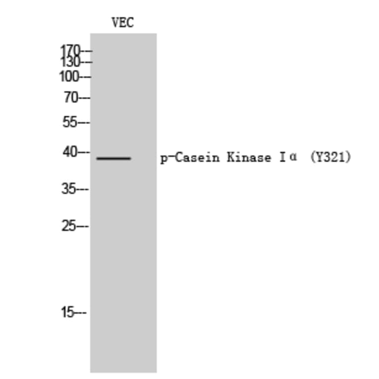 Western Blot - Anti-Casein Kinase I alpha (phospho Tyr321) Antibody (A1194) - Antibodies.com