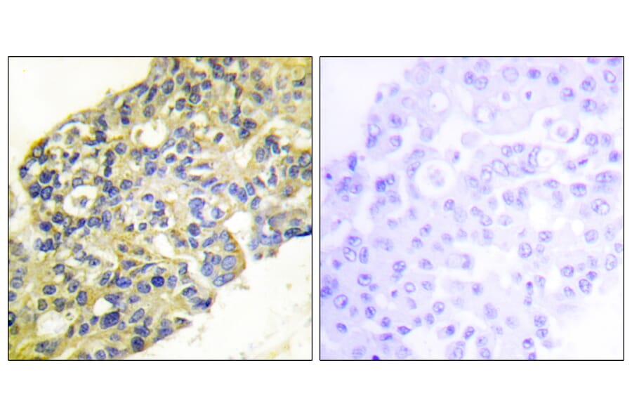 Immunohistochemistry - Anti-PI 3 Kinase p85 alpha + Gamma Antibody (B1224) - Antibodies.com