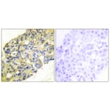 Immunohistochemistry - Anti-PI 3 Kinase p85 alpha + Gamma Antibody (B1224) - Antibodies.com