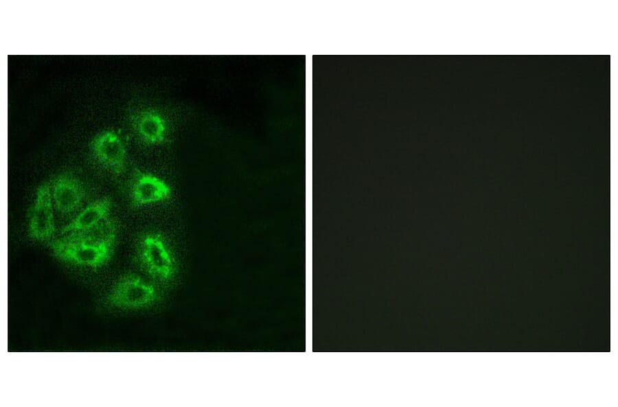 Immunofluorescence - Anti-PI 3 Kinase p85 alpha + Gamma Antibody (B1224) - Antibodies.com