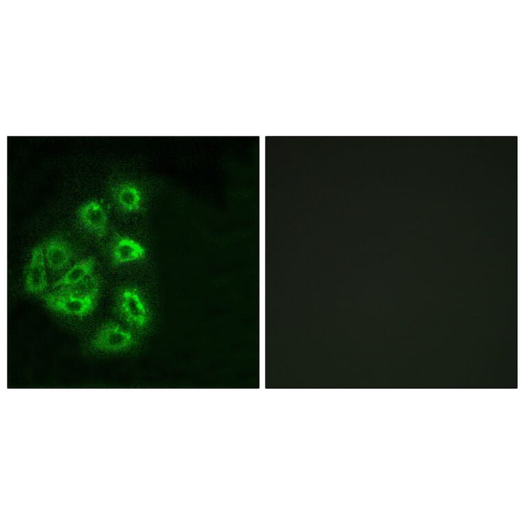Immunofluorescence - Anti-PI 3 Kinase p85 alpha + Gamma Antibody (B1224) - Antibodies.com