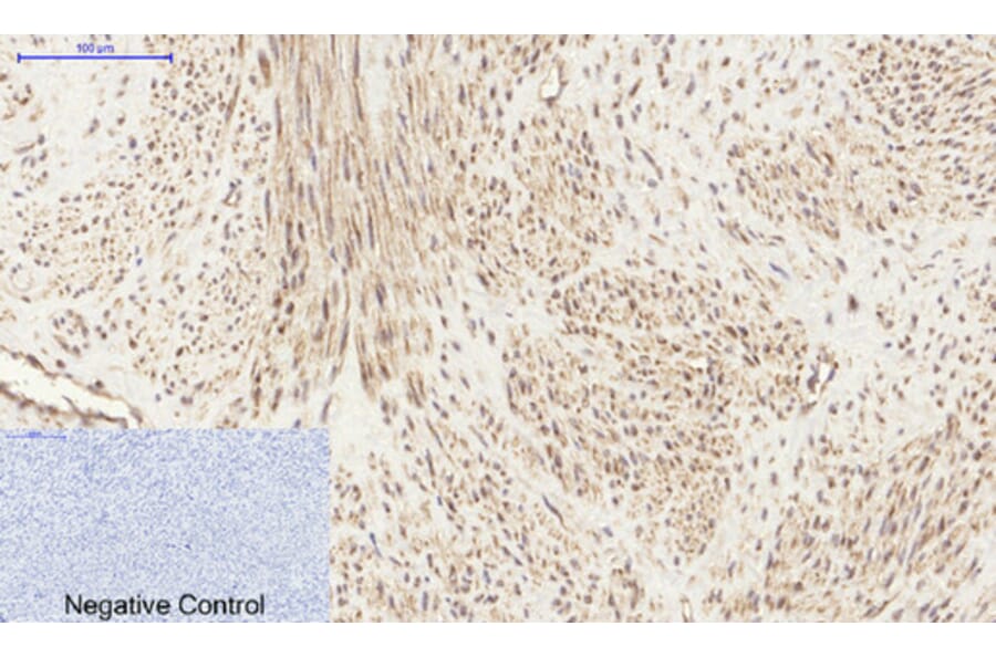 Immunohistochemistry - Anti-PI 3 Kinase p85 alpha + Gamma Antibody (B1224) - Antibodies.com