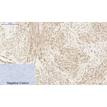 Immunohistochemistry - Anti-PI 3 Kinase p85 alpha + Gamma Antibody (B1224) - Antibodies.com