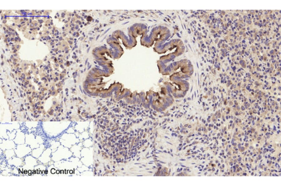 Immunohistochemistry - Anti-PI 3 Kinase p85 alpha + Gamma Antibody (B1224) - Antibodies.com