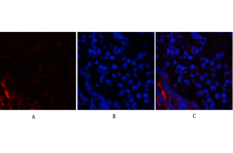 Immunofluorescence - Anti-PI 3 Kinase p85 alpha + Gamma Antibody (B1224) - Antibodies.com