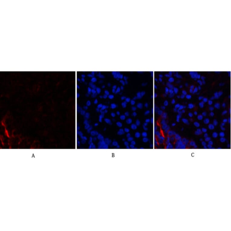 Immunofluorescence - Anti-PI 3 Kinase p85 alpha + Gamma Antibody (B1224) - Antibodies.com