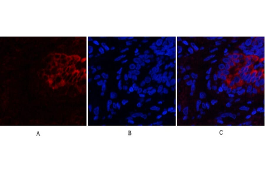 Immunofluorescence - Anti-PI 3 Kinase p85 alpha + Gamma Antibody (B1224) - Antibodies.com