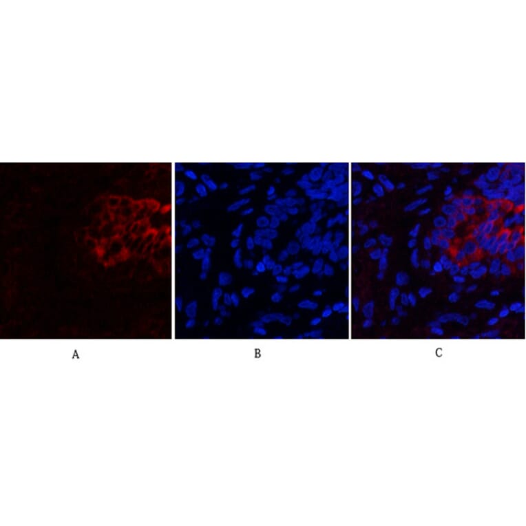 Immunofluorescence - Anti-PI 3 Kinase p85 alpha + Gamma Antibody (B1224) - Antibodies.com