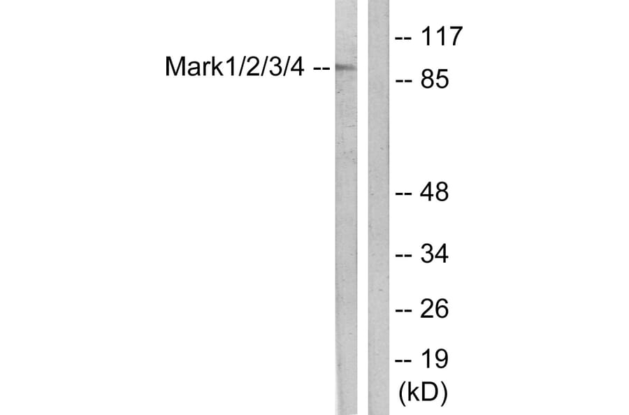 Western Blot - Anti-MARK1 + MARK2 + MARK3 + MARK4 Antibody (B1093) - Antibodies.com