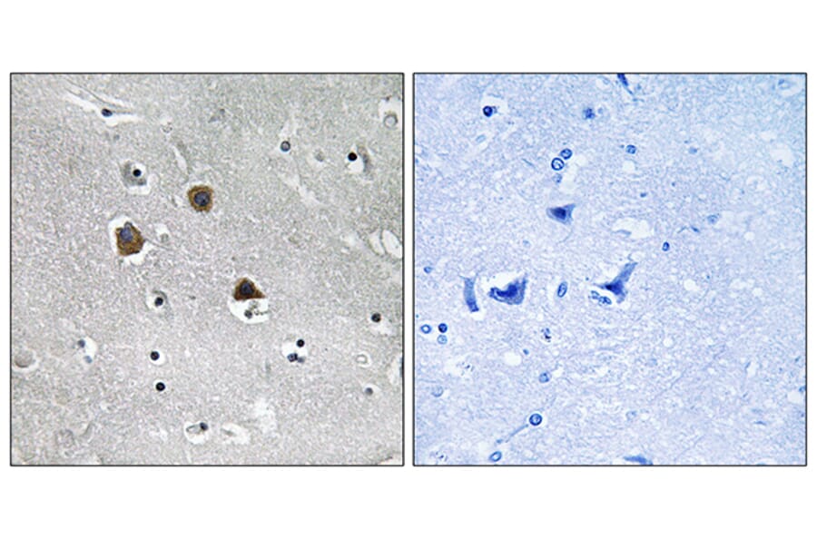Immunohistochemistry - Anti-MARK1 + MARK2 + MARK3 + MARK4 Antibody (B1093) - Antibodies.com