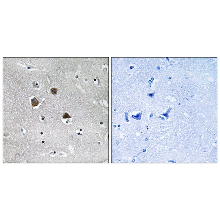 Immunohistochemistry - Anti-MARK1 + MARK2 + MARK3 + MARK4 Antibody (B1093) - Antibodies.com