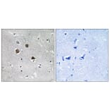 Immunohistochemistry - Anti-MARK1 + MARK2 + MARK3 + MARK4 Antibody (B1093) - Antibodies.com