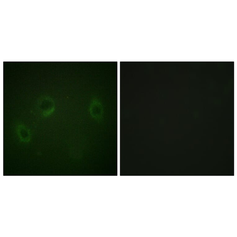 Immunofluorescence - Anti-MARK1 + MARK2 + MARK3 + MARK4 Antibody (B1093) - Antibodies.com