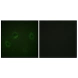 Immunofluorescence - Anti-MARK1 + MARK2 + MARK3 + MARK4 Antibody (B1093) - Antibodies.com