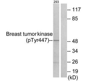 Western Blot - Anti-Breast Tumor Kinase (phospho Tyr447) Antibody (A0783) - Antibodies.com