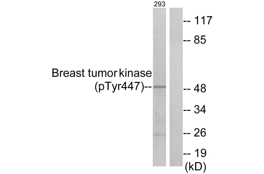 Western Blot - Anti-Breast Tumor Kinase (phospho Tyr447) Antibody (A0783) - Antibodies.com