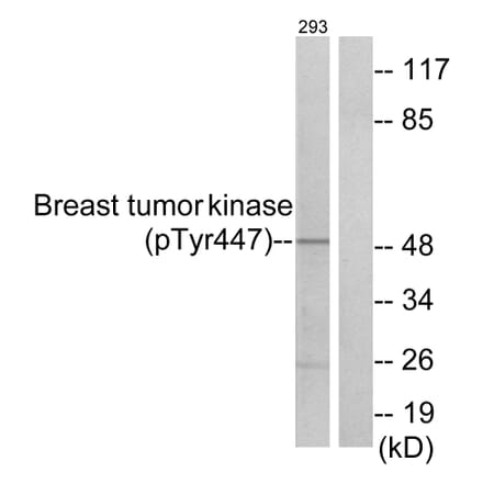 Western Blot - Anti-Breast Tumor Kinase (phospho Tyr447) Antibody (A0783) - Antibodies.com
