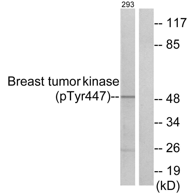 Western Blot - Anti-Breast Tumor Kinase (phospho Tyr447) Antibody (A0783) - Antibodies.com
