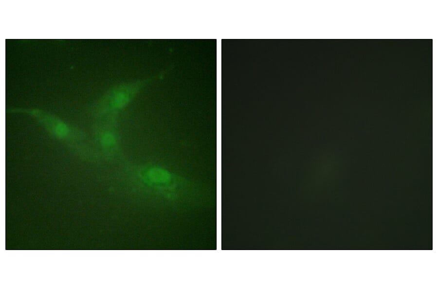 Immunofluorescence - Anti-Breast Tumor Kinase (phospho Tyr447) Antibody (A0783) - Antibodies.com