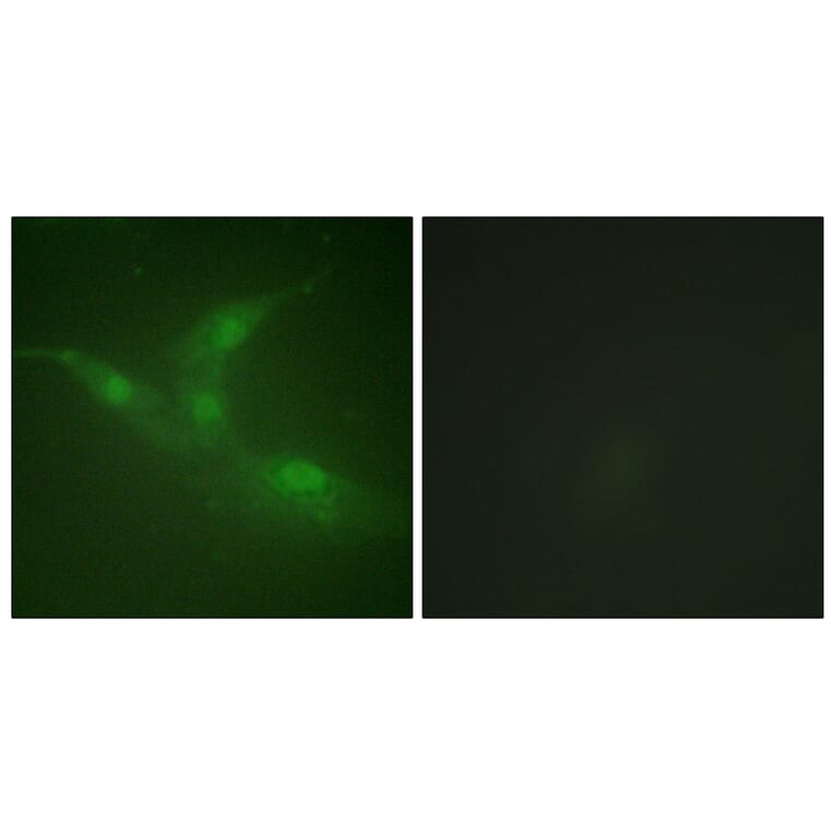 Immunofluorescence - Anti-Breast Tumor Kinase (phospho Tyr447) Antibody (A0783) - Antibodies.com