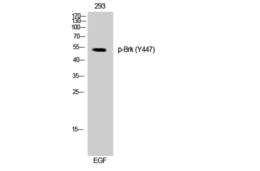 Western Blot - Anti-Breast Tumor Kinase (phospho Tyr447) Antibody (A0783) - Antibodies.com