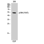 Western Blot - Anti-Breast Tumor Kinase (phospho Tyr447) Antibody (A0783) - Antibodies.com