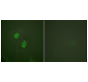 Immunofluorescence - Anti-Estrogen Receptor-alpha (phospho Ser305) Antibody (A0921) - Antibodies.com