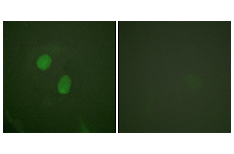Immunofluorescence - Anti-Estrogen Receptor-alpha (phospho Ser305) Antibody (A0921) - Antibodies.com