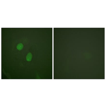 Immunofluorescence - Anti-Estrogen Receptor-alpha (phospho Ser305) Antibody (A0921) - Antibodies.com