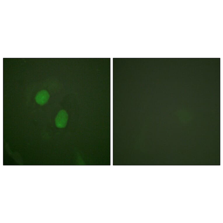 Immunofluorescence - Anti-Estrogen Receptor-alpha (phospho Ser305) Antibody (A0921) - Antibodies.com